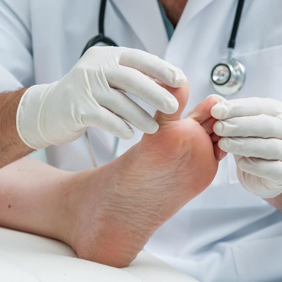 Consulta Médica para Pies