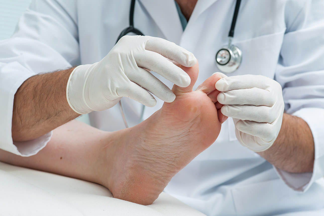 Medical Consultation for feet